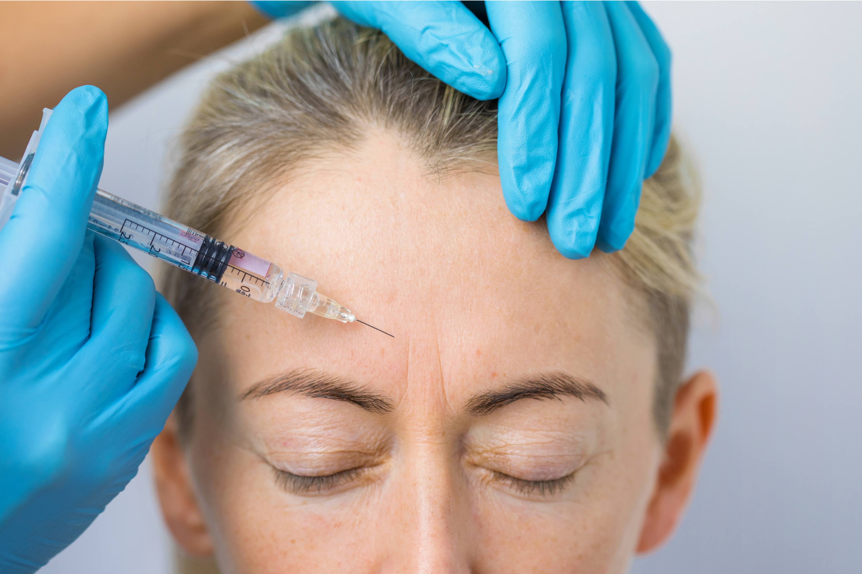 Botox Treatment