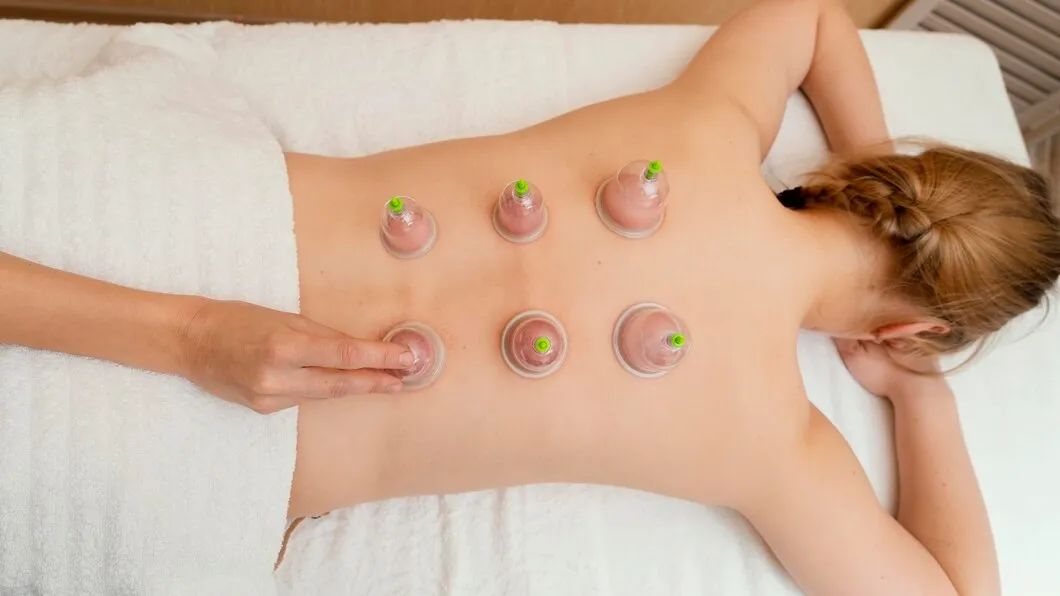 Hijama Cupping Therapy